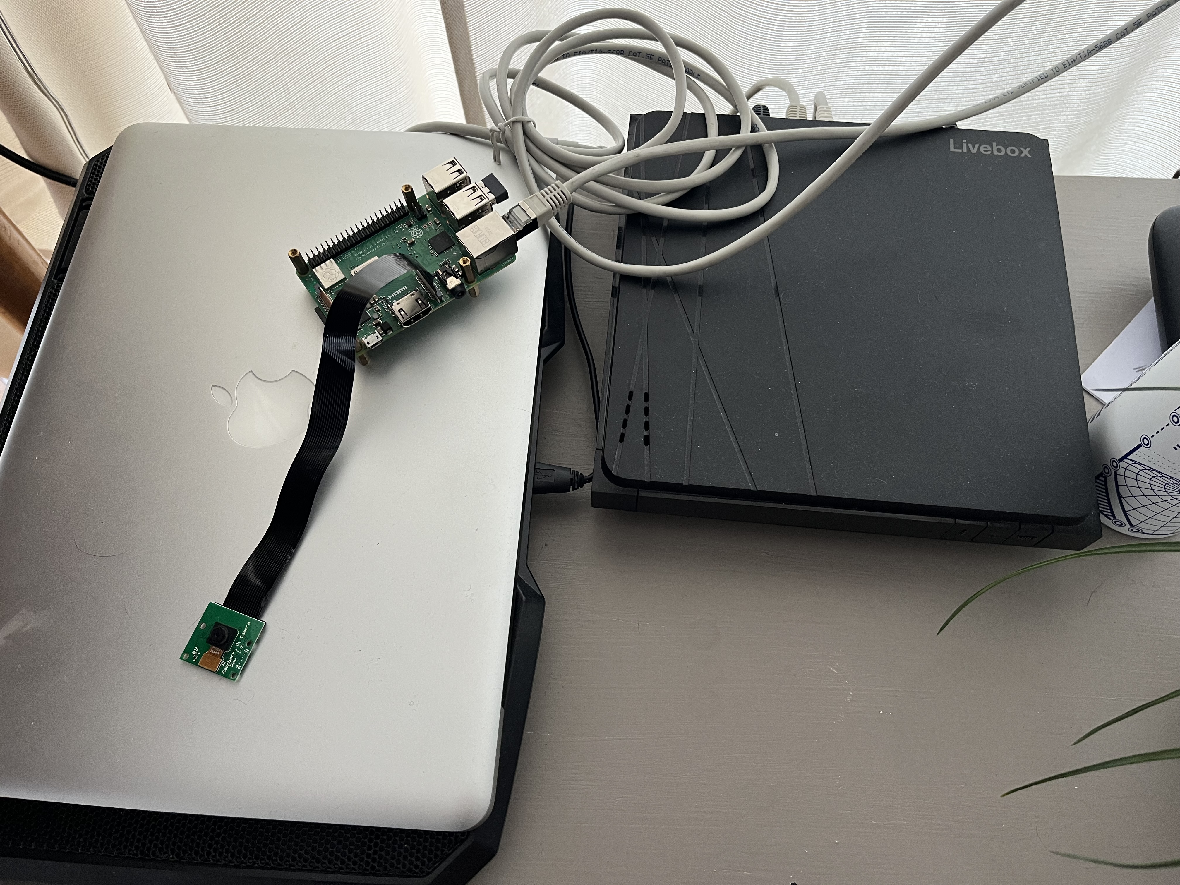Arduino breadboard assembly of ECG with 2 oled displays, one arduino, one heartbeat sensor, buttons and other controls